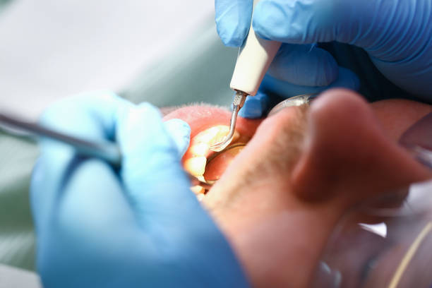 Best Emergency Tooth Extraction in Woodbine, IA