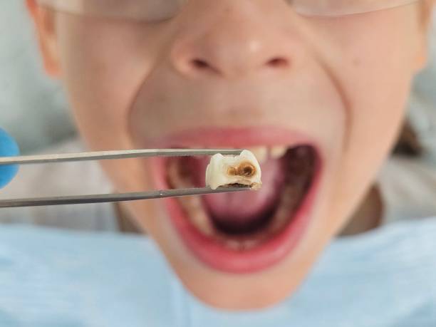 Best Same-Day Emergency Dental Services in Woodbine, IA