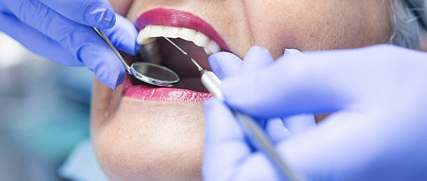 Best Emergency Dental Care for Broken or Chipped Teeth in Woodbine, IA